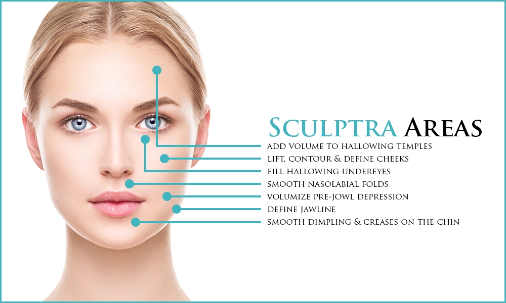 areas treated by sculptra